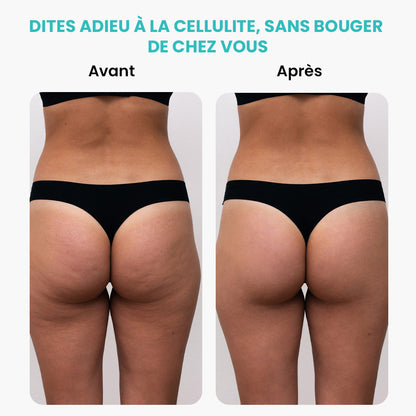 Masseur Rotatif Minceur et Anti-Cellulite Électrique