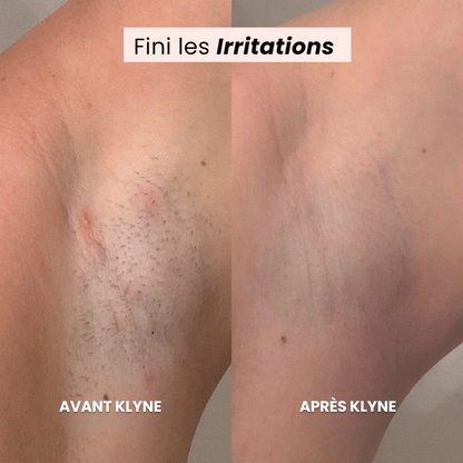 Le Rasoir de Luxe KLYNE®