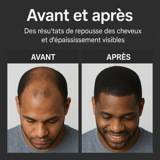 Shampoing activateur de racines