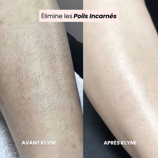 Le Rasoir de Luxe KLYNE®